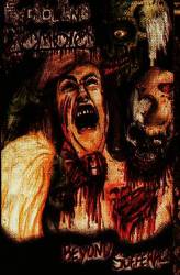 Exploding Zombies : Beyond Sufferage